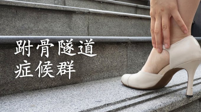 是足协老旧派需要改变。